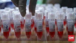 Deteksi Corona, Pemerintah: Tes Cepat Molekular Lebih Kilat dari PCR