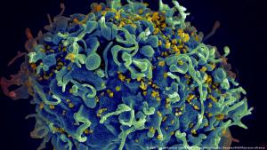 Pasien Ketiga HIV Berhasil Sembuh Berkat Terapi Sel Punca