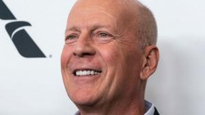 Bruce Willis Mengalami Demensia Frontotemporal, Penyakit Apa Itu dan Bagaimana Gejalanya?