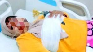 Ngeri, Wanita di Gowa Sulsel Kena Busur di Payudara Saat Naik Motor